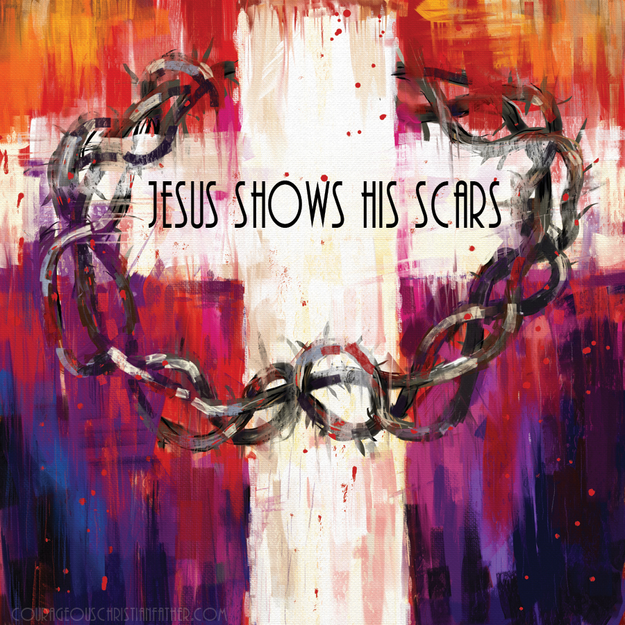Jesus Shows His Scars - Jesus shows His Scars, wounds to His disciples to show them He was who He says He is. Those scars are also a reminder of His payment for us. What He did for us on the Cross! #Scars #Easter