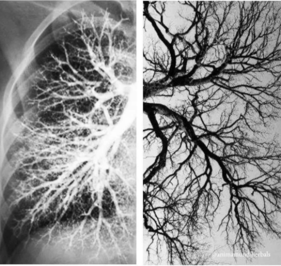 Do Lung pictures resemble tree branches?